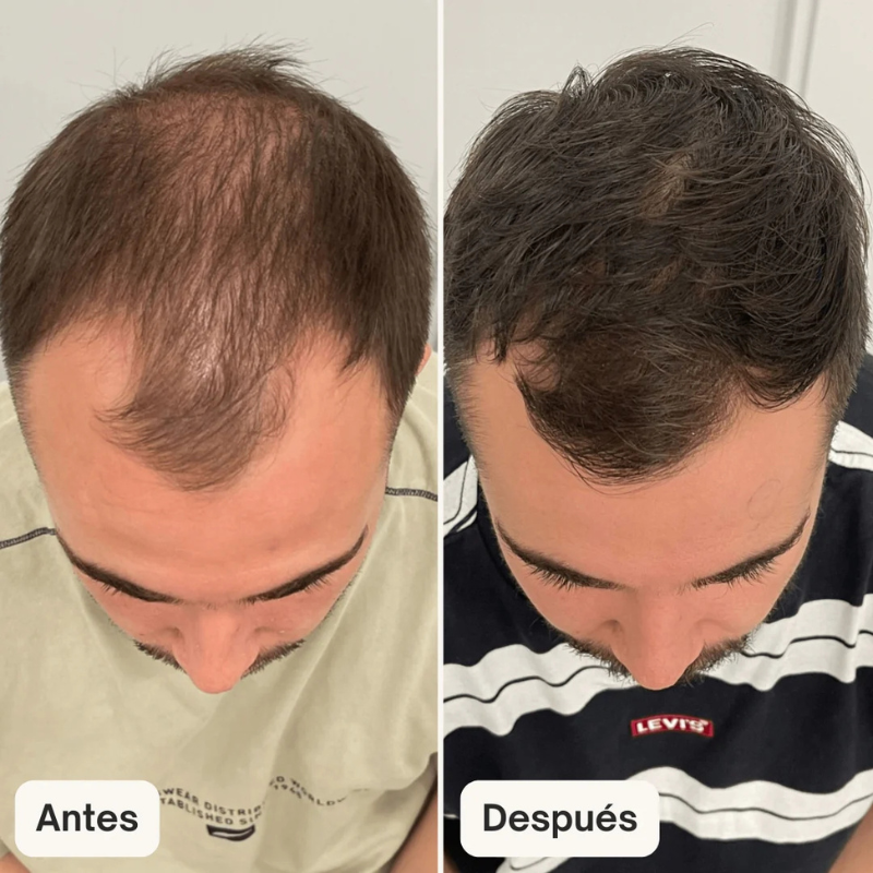 Veltrix™ Serum Intensivo De Crecimiento Capilar